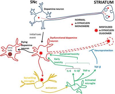 Parkinson’s Disease: Can Targeting Inflammation Be an Effective Neuroprotective Strategy?